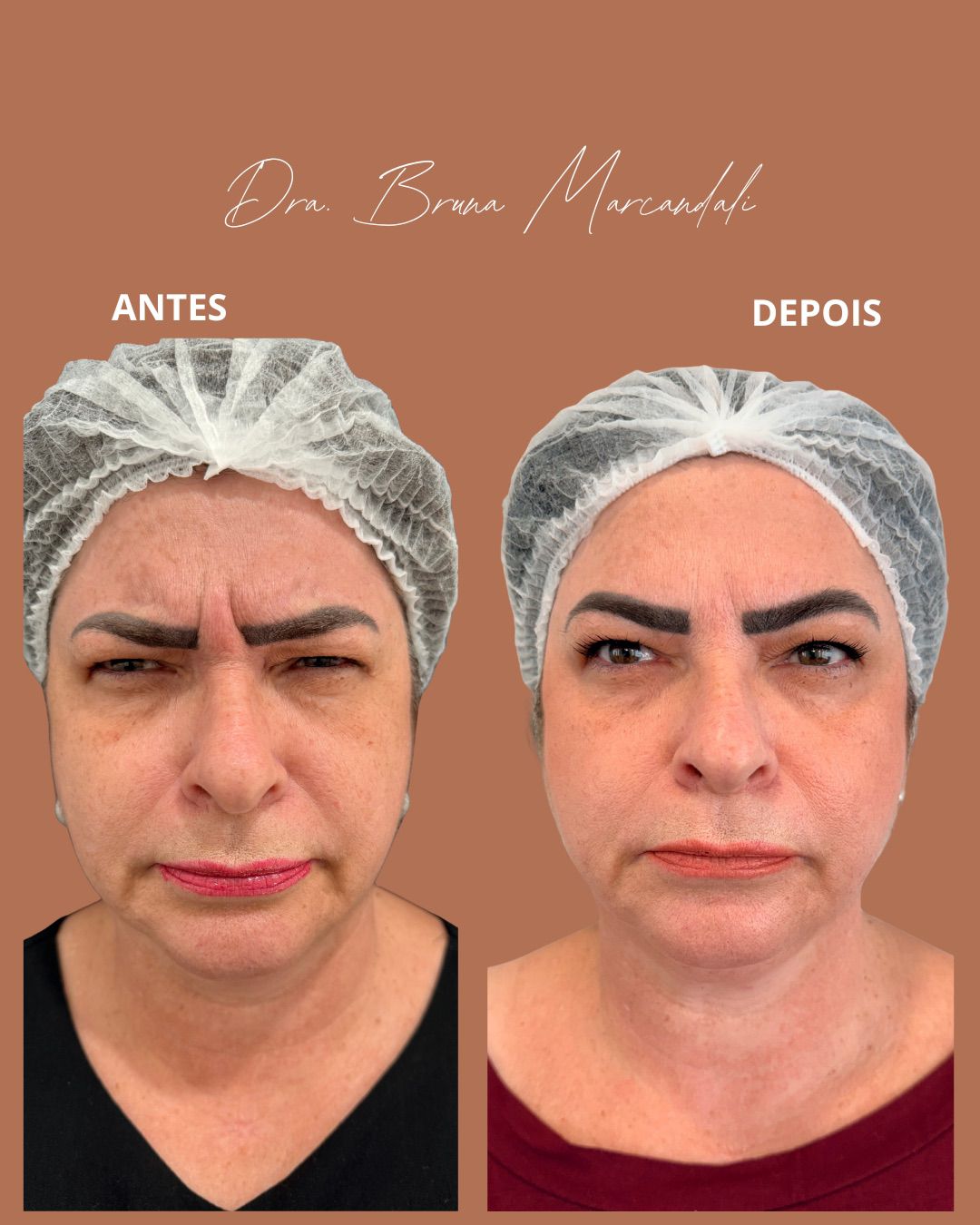 Resultado  — imagem 1