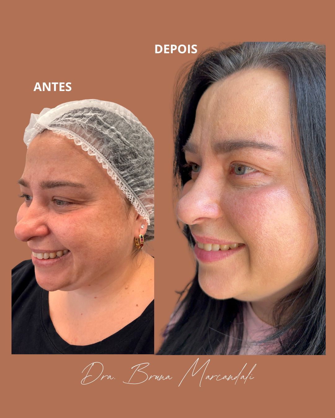 Resultado  — imagem 4