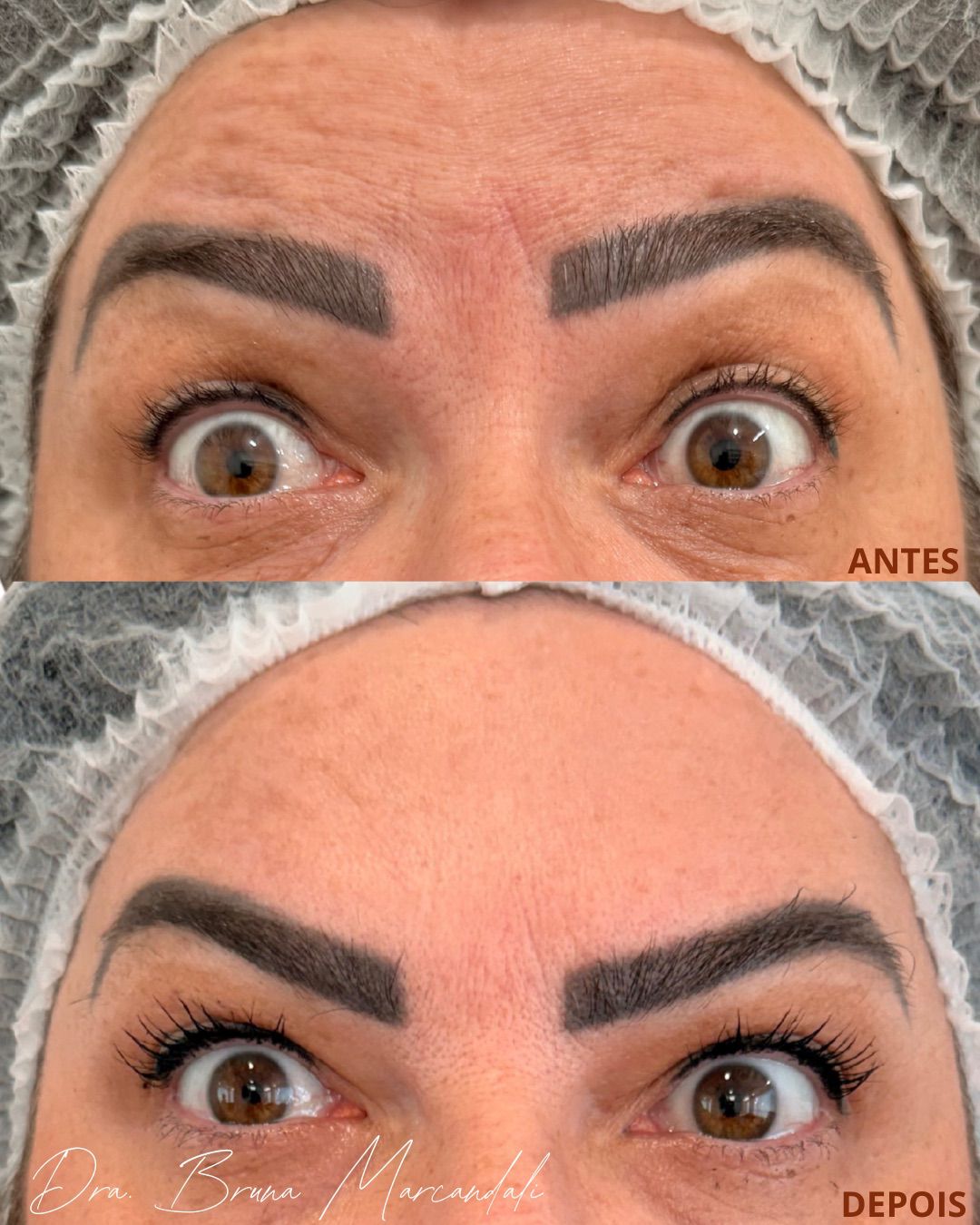 Resultado  — imagem 4